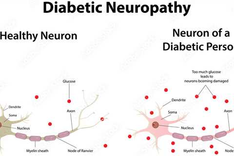 Oral Hypoglycemic Agents For Diabetes Treatment Plan