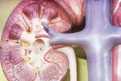 What Is The Link Between Microalbuminuria And Diabetic Nephropathy?