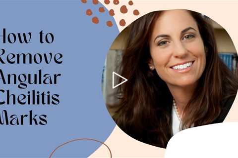 How To Remove Angular Cheilitis Marks - How To Remove Angular Cheilitis Marks
