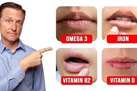 5 Things Your LIPS Can Tell You about Your Nutritional State