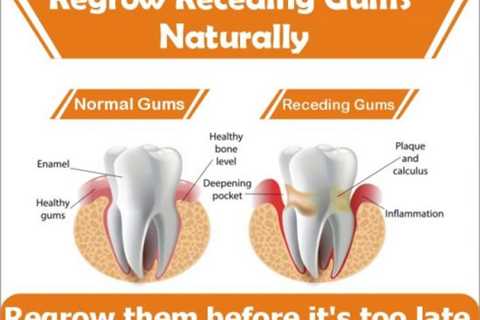 Gum Regrowth Products For Good Dental Care - Deflate The Mate