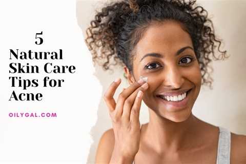 5 Natural Skin Care Tips for Acne - Oily Gal