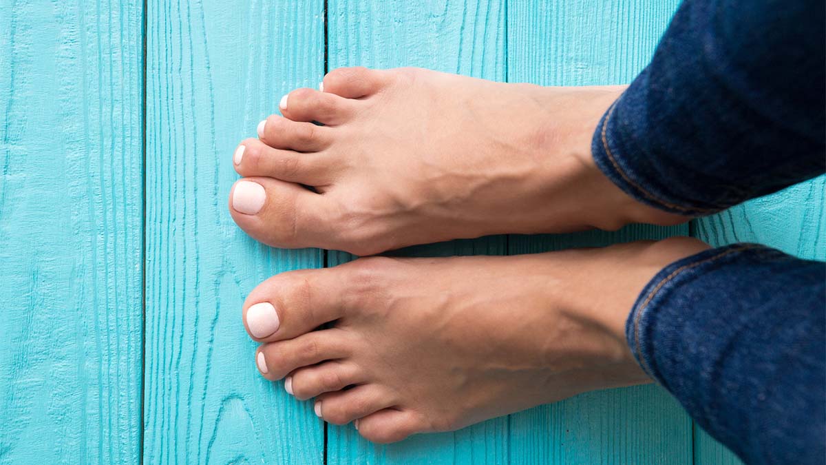 How Can I Clear Up This Toenail Fungus?: Expert Health Advice for Women Over 40