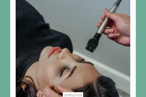 Skin Tightening, Botox and Lip Fillers by Skinsation LA