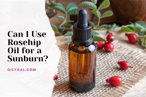 Can I Use Rosehip Oil for Sunburn? Natural Remedy for Sunburns - Oily Gal