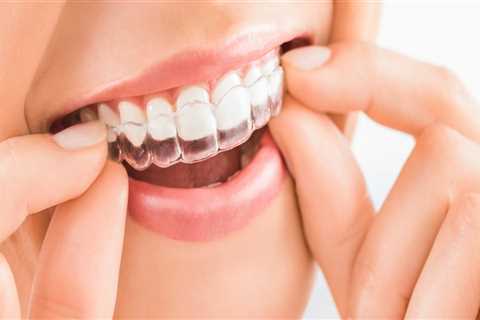 Why is invisalign faster than braces?