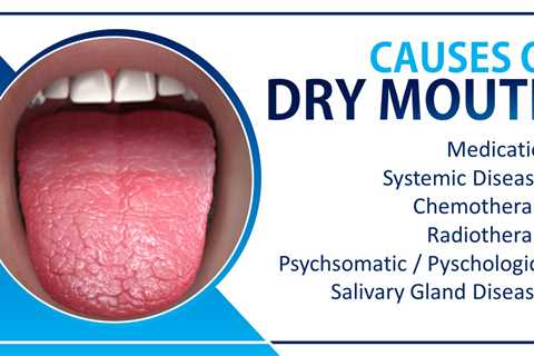 Dry Mouth Treatment Products