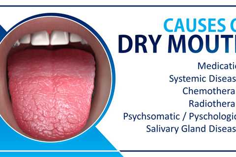 How to Relieve Dry Mouth