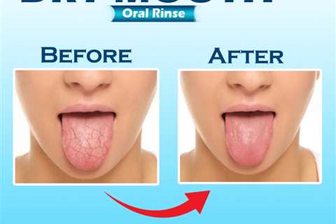 cure dry mouth at night