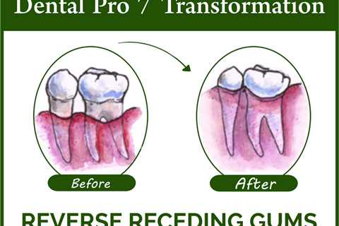 Dental Pro 7 vs Oramd