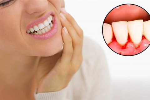 Bleeding Gums: Symptoms, Causes & Treatment - Health Answers Site