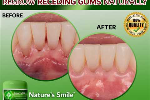 Natures Smile in Stores