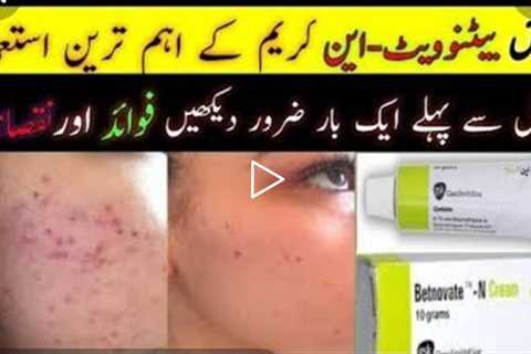 Best Cream For PimleslBestl cream For acne| Best Cream for pimples in pakistan