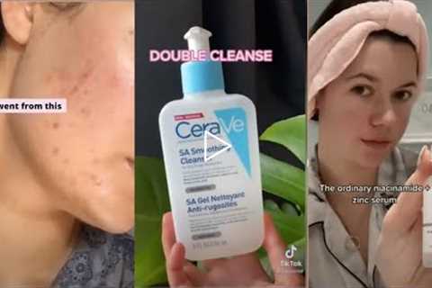 TIKTOK ACNE HACKS | Best Skincare Routines tiktok compilation