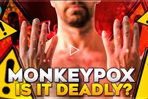 Monkeypox Causes and Symptoms| Health Hacks Infinity