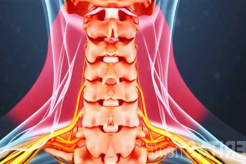 How do you know if neck pain is serious?