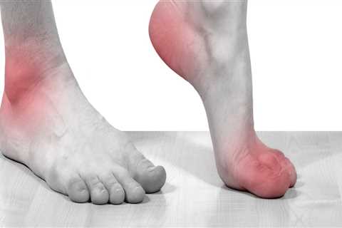 Can you rub cbd oil on your feet for neuropathy?