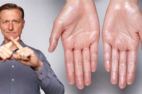 How to Stop Excessive Sweating (Hyperhidrosis)