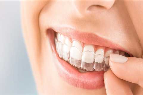 Do teeth aligners damage teeth?