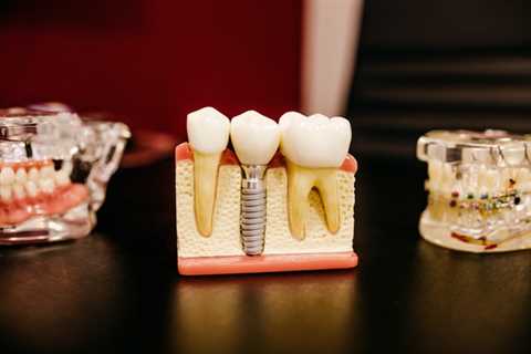5 Things To Consider When Choosing A Family Dentist