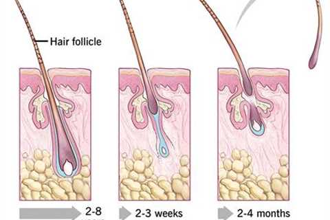 What Could Cause Hair Regrowth in Older Men?