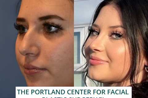 The Portland Center for Facial Plastic Surgery : Rhinoplasty, Facelift Surgery