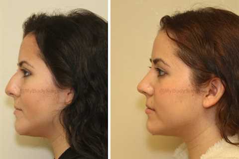 Sugar Land Plastic Surgery