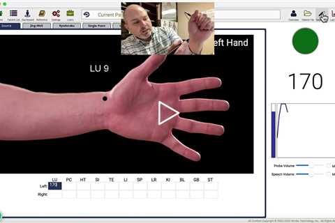 AcuGraph Exam: How to Re-Do a point measurement BackUp