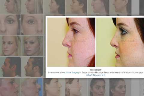 Sugar Land Plastic Surgery