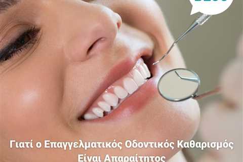 Standard post published to Smalto Dental Clinic at March 29, 2023 10:00