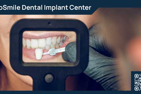 Standard post published to ProSmile Dental Implant Center at March 17, 2023 16:01