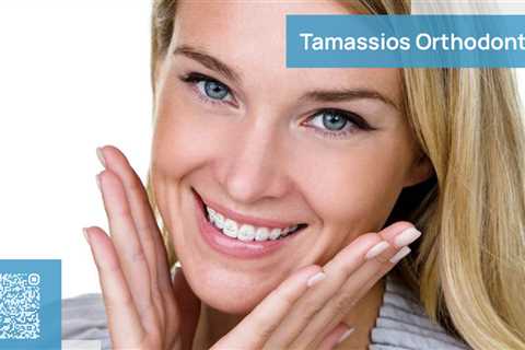 Standard post published to Tamassios Orthodontics - Orthodontist Nicosia, Cyprus at March 11, 2023..
