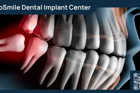 Standard post published to ProSmile Dental Implant Center at April 18, 2023 16:00
