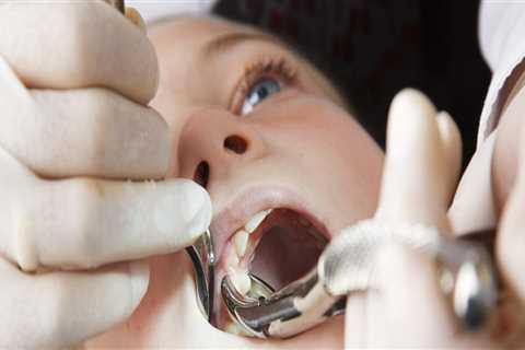 Can Kids Receive TENS Treatments in Dentistry?