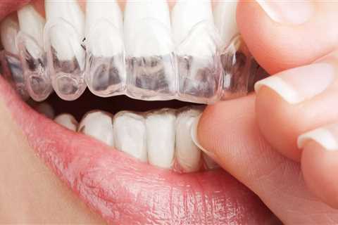 What Types of Teeth Can Be Treated with Invisalign Clear Braces?