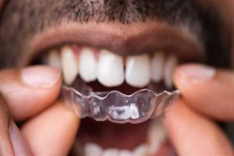 Maintaining Your Smile After Invisalign Clear Braces