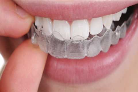 What to Do in an Emergency While Wearing Invisalign Clear Braces