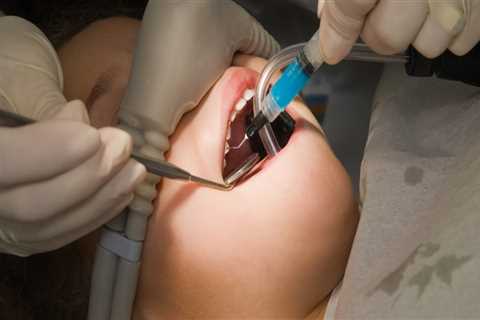 Is IV Sedation Safe for Dental Work?