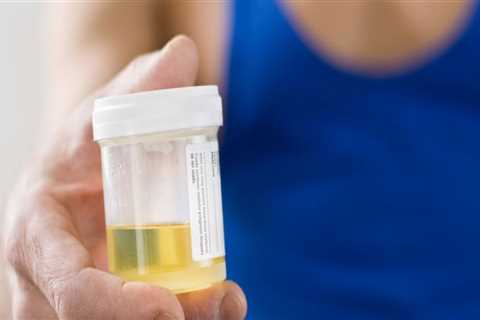 Can Delta 8 THC Show Up on a Urine Test?