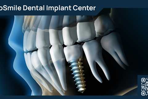 Standard post published to ProSmile Dental Implant Center at May 20, 2023 16:00