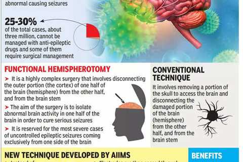 Epilepsy Prevention Tips