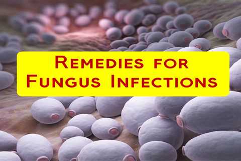 10 Home Remedies for Fungal Infection - Home Remedies App