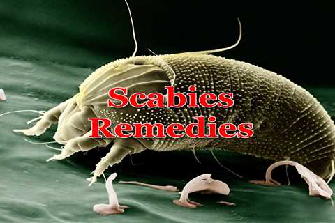 10 Home Remedies for Scabies - Home Remedies App