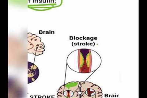 Intermittent fasting for beginners - Telugu