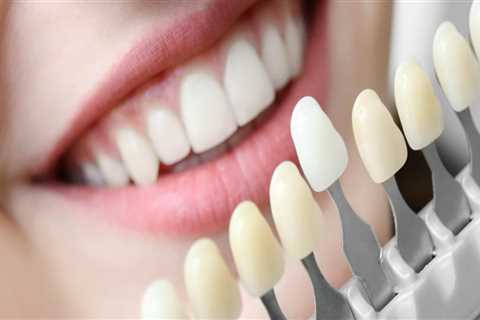 How Can Cosmetic Dentistry Improve Your Smile