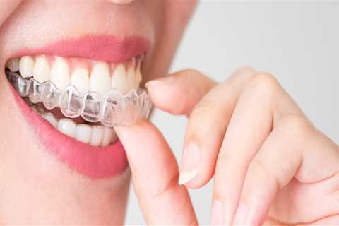 Can Invisalign Cause Fillings to Fall Out?