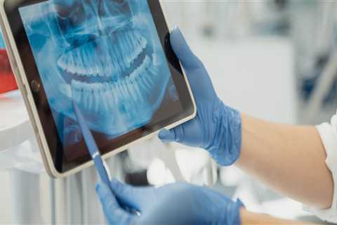Understanding Dental X-Rays: An Essential Guide For Patients In Round Rock, Texas