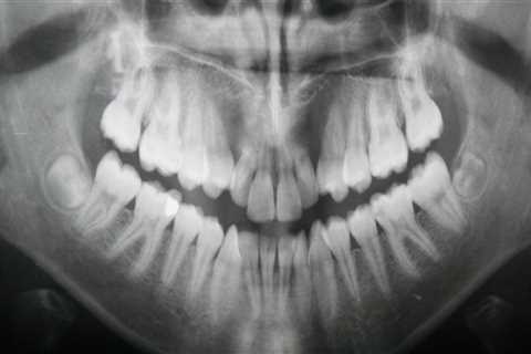 When are dental x rays necessary?