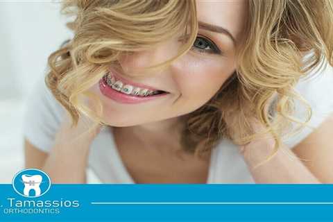 Standard post published to Tamassios Orthodontics - Orthodontist Nicosia, Cyprus at July 18, 2023..