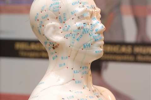 How To Train In Acupuncture?